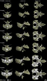 In the future, the resulting 3D atlas could help improve prenatal examination of foetal morphology and potential treatment strategies. | Autor: CEITEC BUT